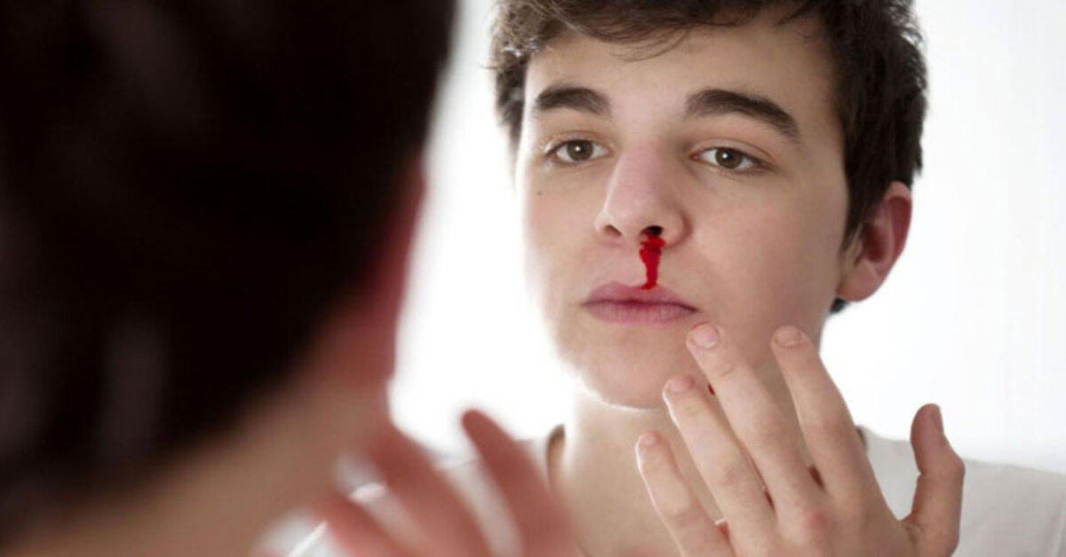 6 Common Causes Of Nose Bleeding And Quick First Aid Guide